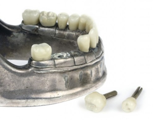 vintagemedical:  Antique dental model by Vecabé. The full set of teeth are made from enamel and would have been painstakingly crafted individually.Each one is secured to the mandible with brass pin and can be removed. They fit together perfectly to form