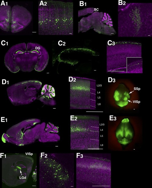 (Image caption: Lines labeling cortical subplate, mesencephalic, and diencephalic cell types (see Fi