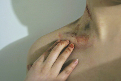 XXX Cuts and bruises. by ad-libitur  photo