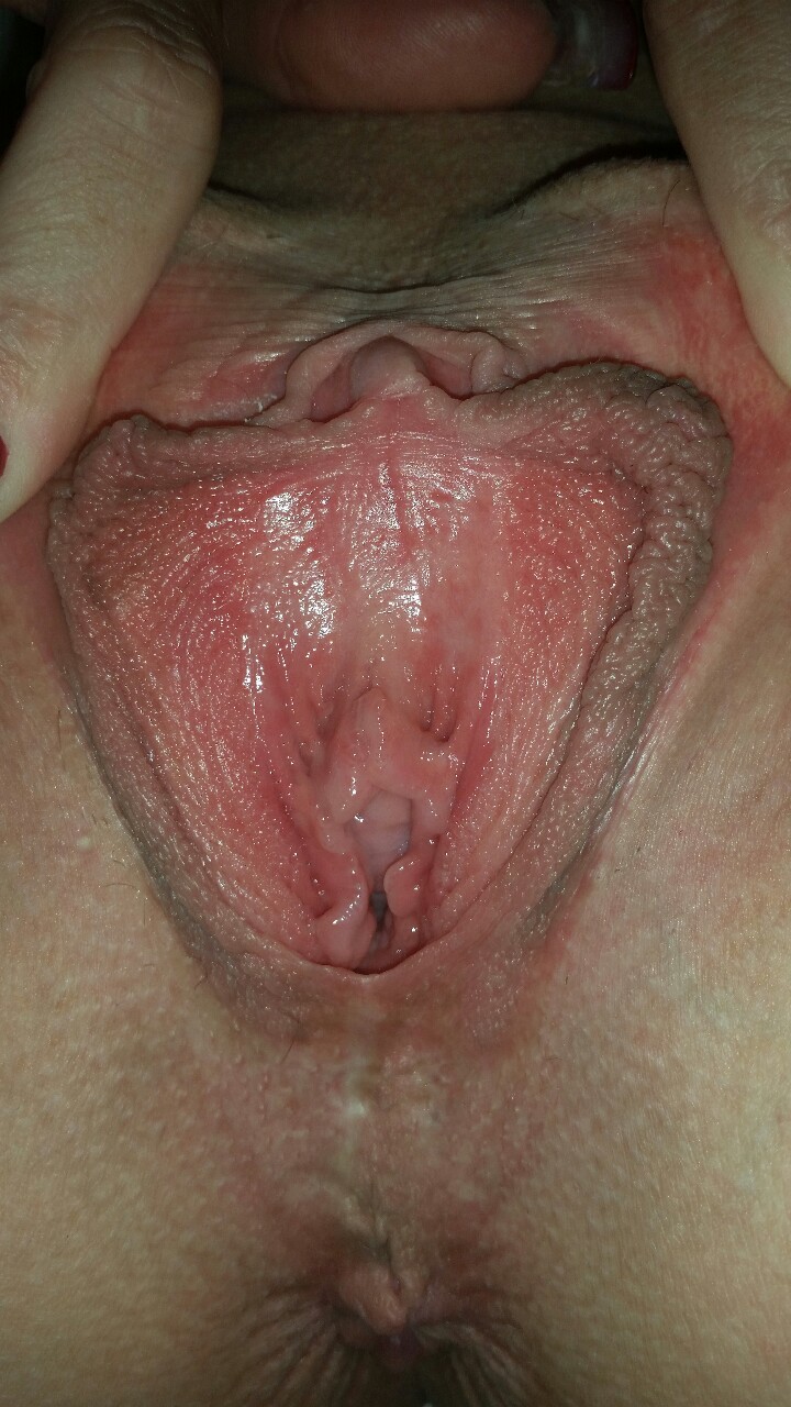 fletchbeast1:  The slut wife’s freshly shaved pussy.. Time to dig in…