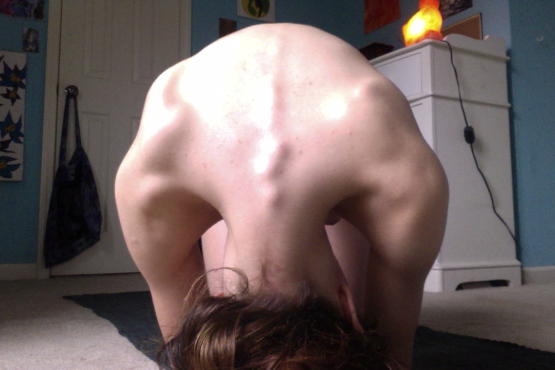 Say hello to my severely fucked up vertebrae.Physically, this is why I practice yoga.