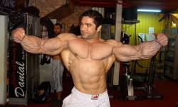 drwannabe:  Majid Bozorg. mirin the vascularity.