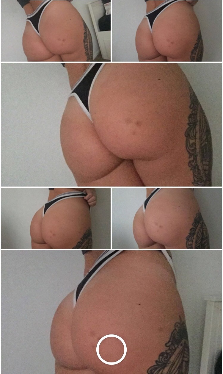 hallucin8:  bruised 🍑 modern art
