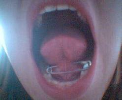 SOURCE SUBMITTER’S COMMENT:  I was curious about getting a tongue web piercing (commonly known as fr