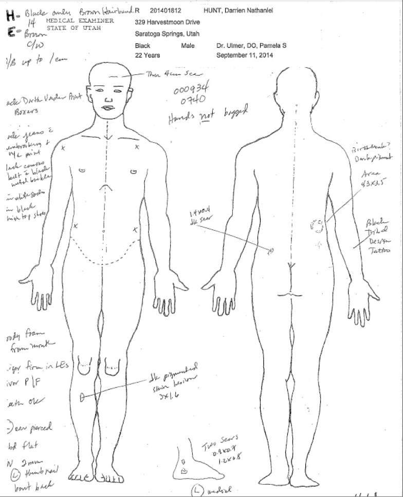 revitiligo:  land-of-propaganda:  #DarrienHunt #BlackLivesMatter Official Autopsy: