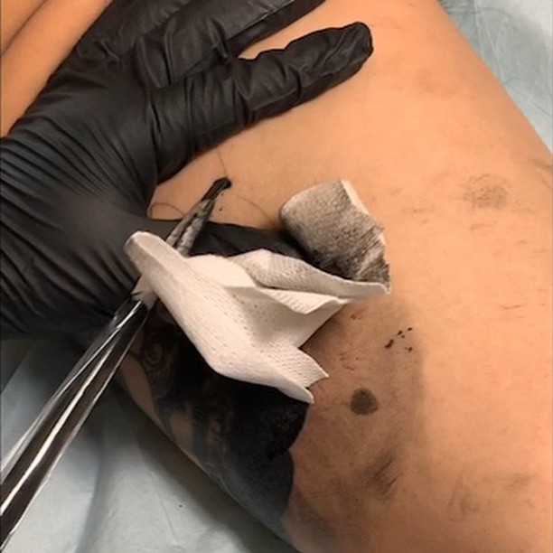 刺青師 龍元tattooist Ryugen 鳳凰 肩額七分袖houou Asian Phoenix Traditional 刺青師 龍元tattooist Ryugen 鳳凰 肩額七分袖houou Asian Phoenix Traditional