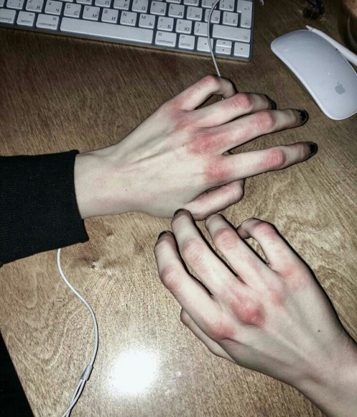 aesthetic hands