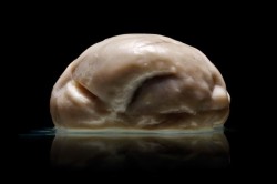 mediclopedia:  Some amazing photography by Adam Voorhes. All of these brains are from the Austin Mental Hospital. I don’t have too much to say about the series, but the top one without any sulci or gyri… enchanting isn’t it? 