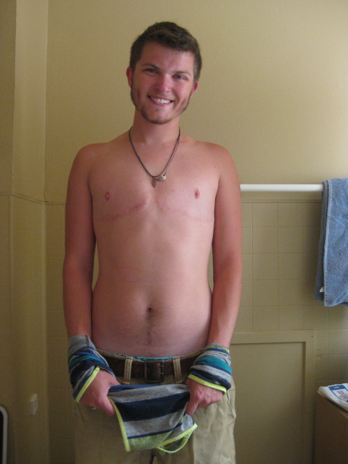 cameoamalthea:  iknowwhoholdstomorrow:  azryal00:  leaveyourdoubt:  askytheycannotbury:  Oh what a difference a year makes. one year post-op. one year three months on T. original post: this is what a man looks like.  the smile is the real difference