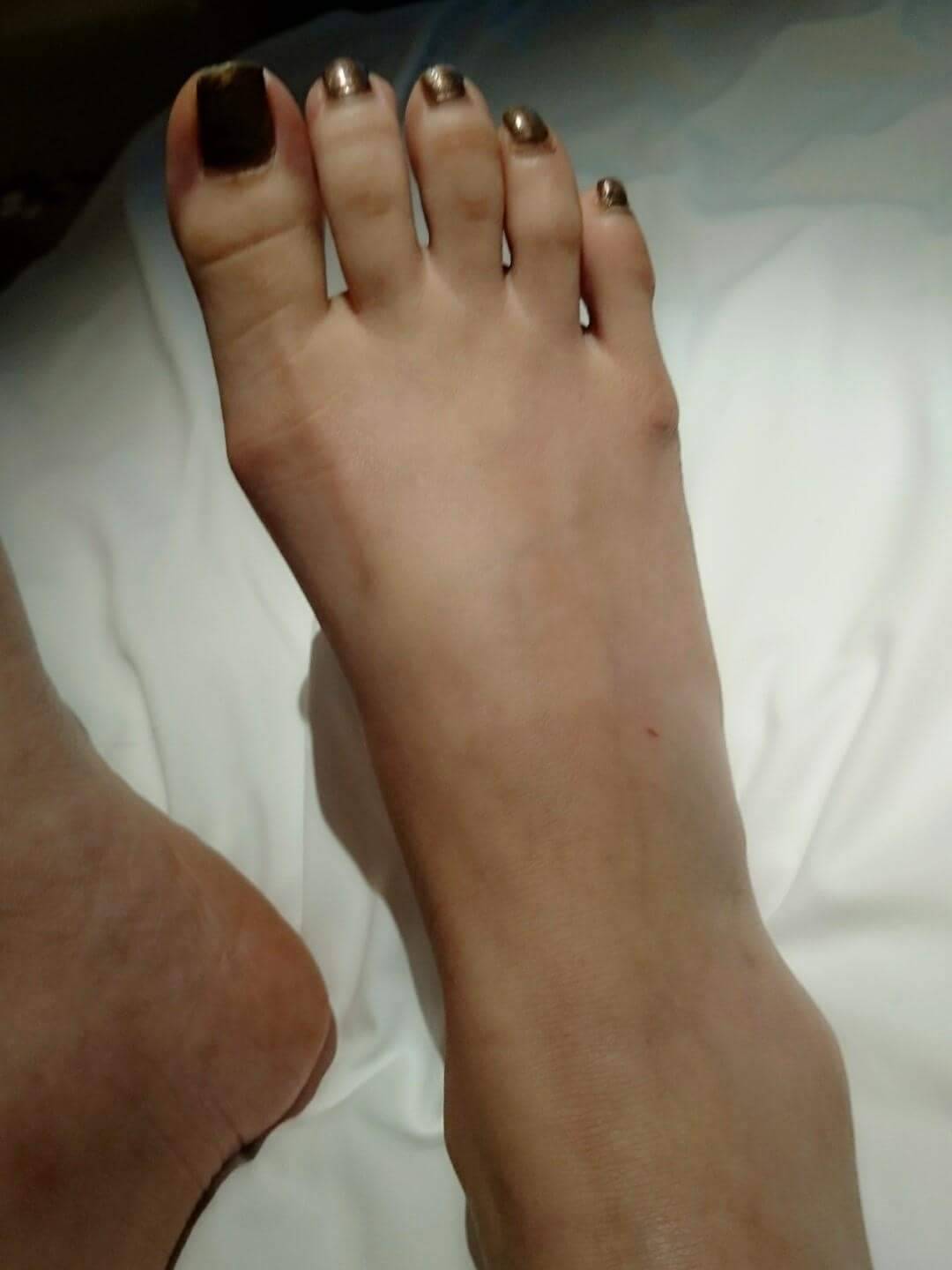 香港腳趾迷