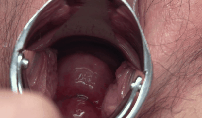 labellechamber:  Looks tasty jiggly lips of the uterus remind me of the feeling as