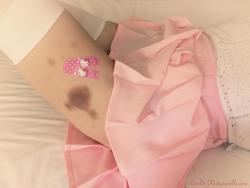 baron-twisted-of-pervertshire:  littl3-kitty:  I just don’t know what’s prettier! My beautiful bruises or the Kitty plasters 💕    Definitely the bruises you idiot, and you’ll be getting more………stupid.