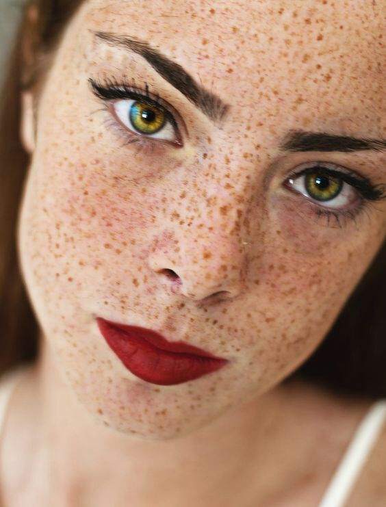 the-455:  Lovely Glorious Freckles….