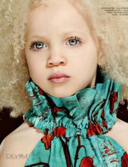 blackbeautyoftheday:  Ava Edney (Albino Baby Fashion Model) 