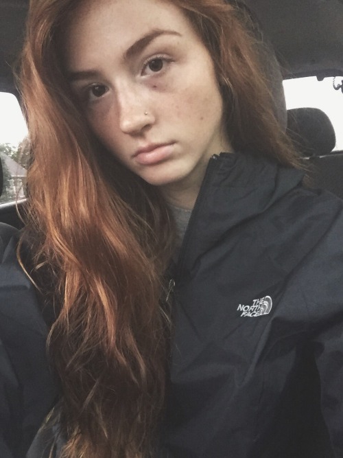 tyedyed-sunsets:  no makeup, rainy day, & frizzy hair (-: love