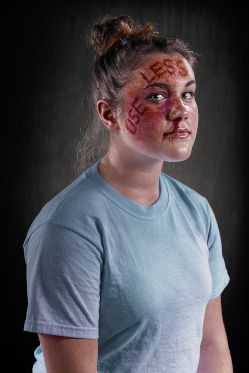 girl-in-nike: tonytobar: What if verbal abuse left the same scars as physical abuse? Would it be tak