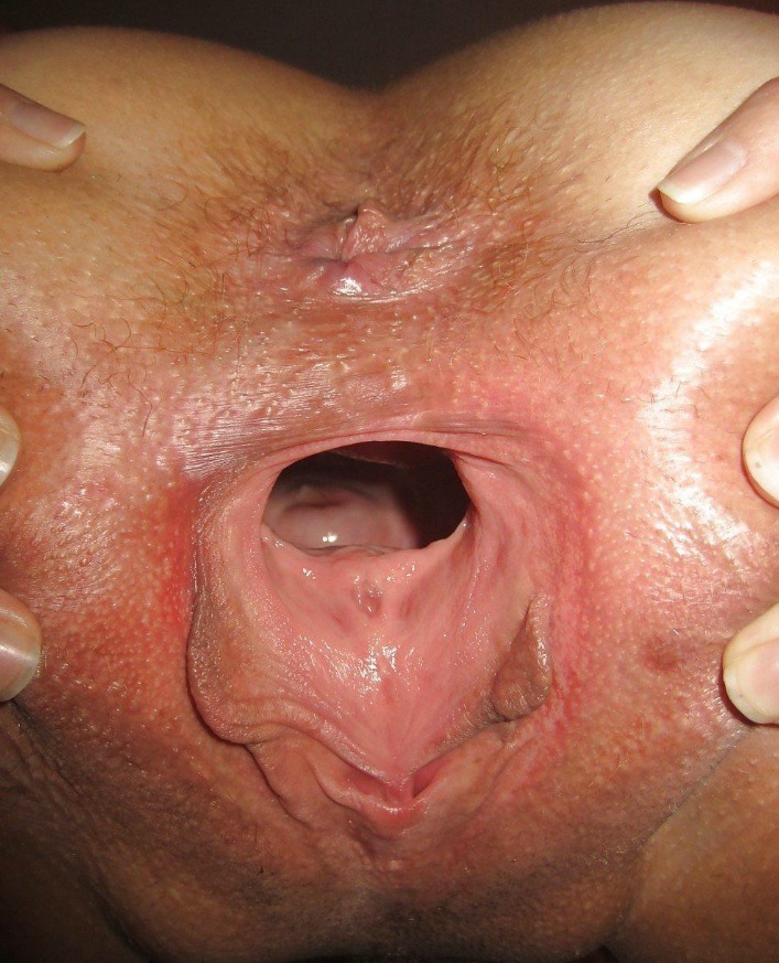 Huge Holes. Huge holes,labia,milking nipples!