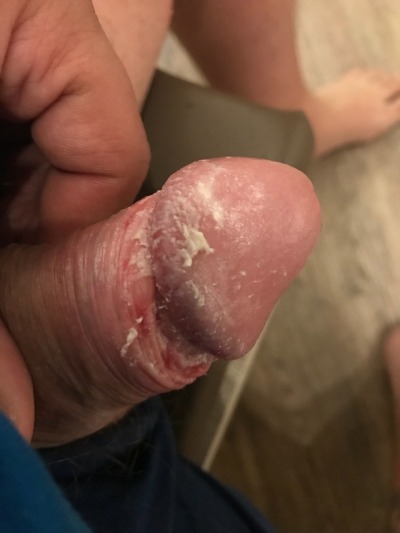 Mmm Nice Cheesy Cock Thanks For The Submission Tumbex