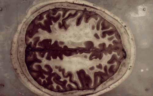lowfi666:  brainfart