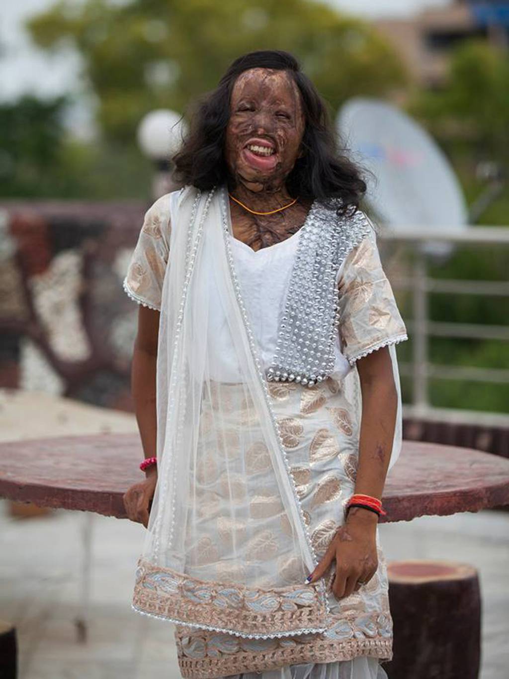 redsuelo:  amberrosehairline:  myvoicemyright:   Acid attack survivors in India model