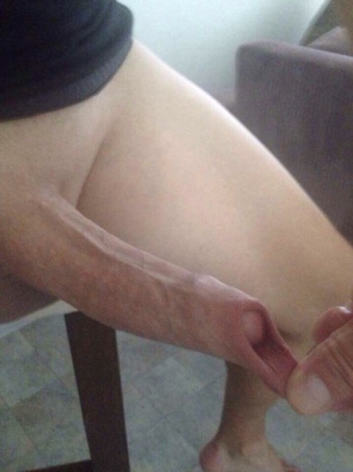 uncut2cut:  circumcisedperfection:  Thanks for the submission I agree this is an Aussie cock ready for a circumcision  Oh definitely! Think how much better it will look…