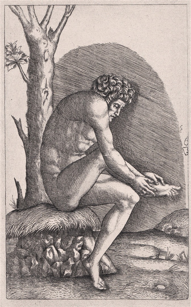   Male Nude Examining His Wounded Foot, 19th century héliogravure byCharles Amand-Durand