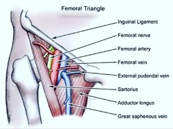 doctordconline:  This triangle you shouldn’t forget !!  @@@ Tag your friends @@ #surgery #hernia #femoraltraingle #femoralhernia #surgeon #usmle #pathology #anatomy #usmlestep1 #usmlestep2 #doctor #doctordconline #nhs #nurse #nursing #university #hospital