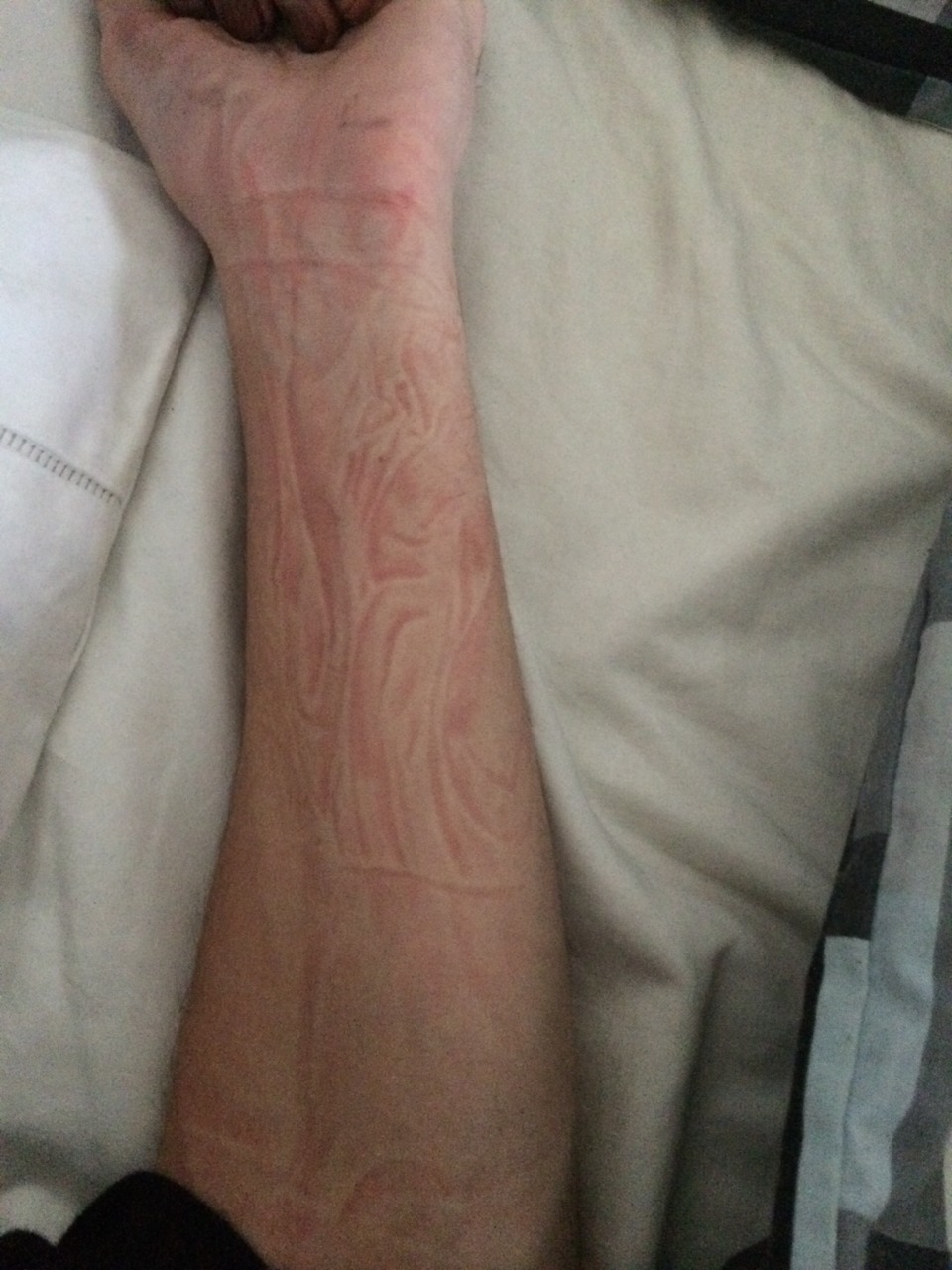 scumdeath:  I slept on my arm