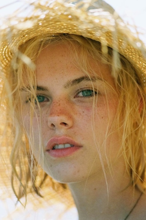 frecklesadmirer:Freckles Admirer Klasse Sommersprossen