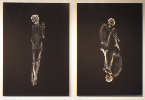 odditiesoflife: Intimate X-Ray Couple Portraits What would normally be intimate portrayals of couple