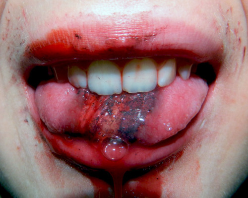 scars-on-your-mind:  -