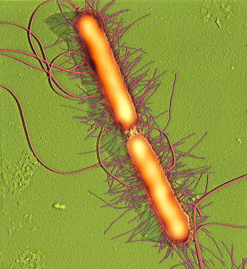 Proteus OX19 and the Polish Schindler,Proteus OX19 is a strain of the bacterium Proteus vulgaris, a 