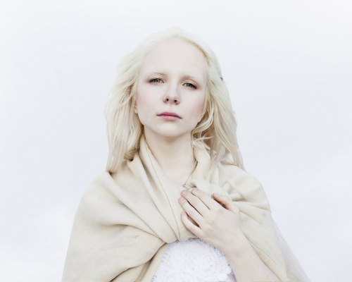 albino girl