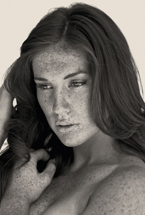 s0mmerspr0ssen:   For his recently published picture book Freckles (Splice Pictures Publishing), the Swiss photographer Reto Caduff has taken pictures of freckled women all over Europe. His pictures prove: freckles are beautiful. Don’t hide yourself