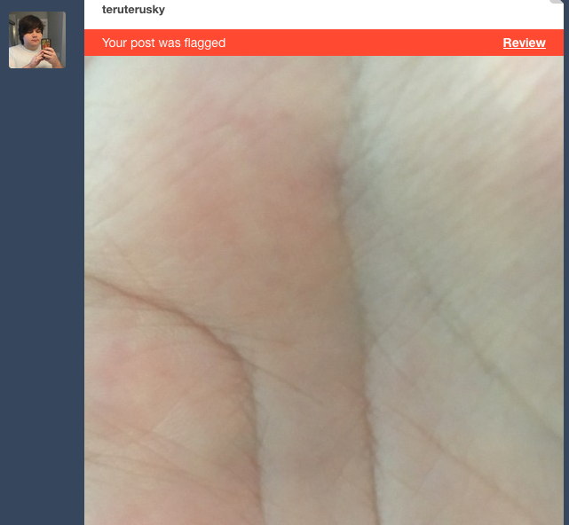 teruterusky: teruterusky:  Literally just a picture of my palm. Lets see if this