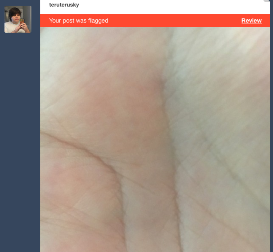 teruterusky: teruterusky:  Literally just a picture of my palm. Lets see if this gets flagged  Good job you stupid website 