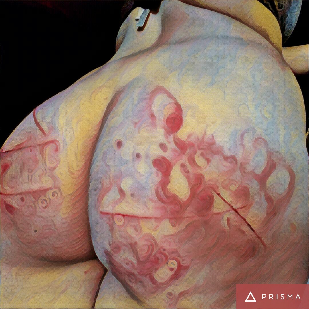 bellamomella:  alphabetacake:  But seriously. This ass  Bruises and cuts look so