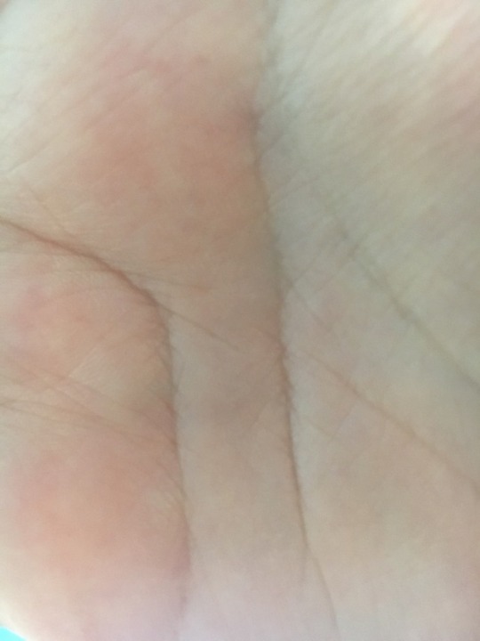 teruterusky: teruterusky:  Literally just a picture of my palm. Lets see if this gets flagged  Good job you stupid website 