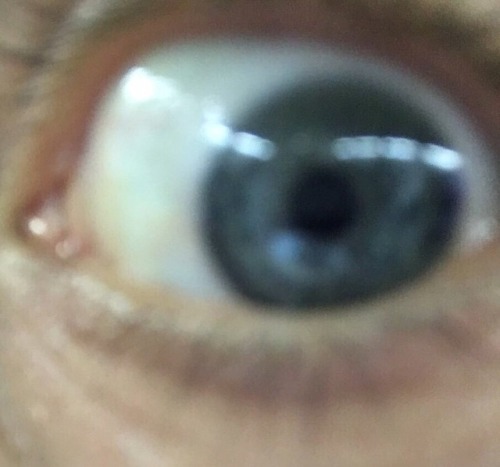 Misha + Extreme Close-ups