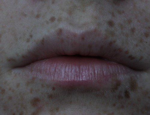 skygrl:why would the universe curse me w freckled lips honestly