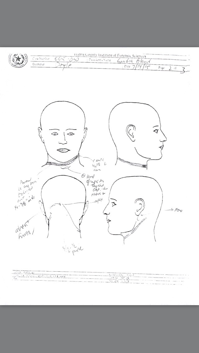 melanieh1:  Black lives matter   #justiceforsandy  This is The autopsy report.  Be