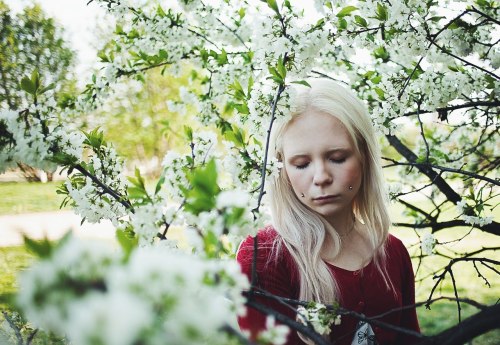 albino girl