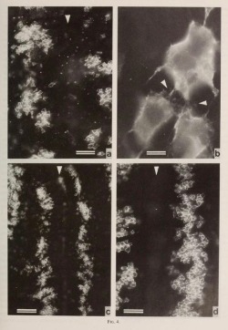 nemfrog:  The appearance of epithelial cells