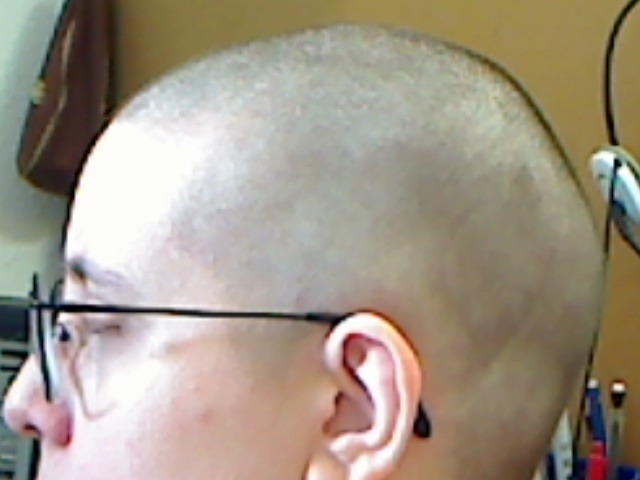 The guard on the clippers slipped. I was supposed to still have hair &hellip;