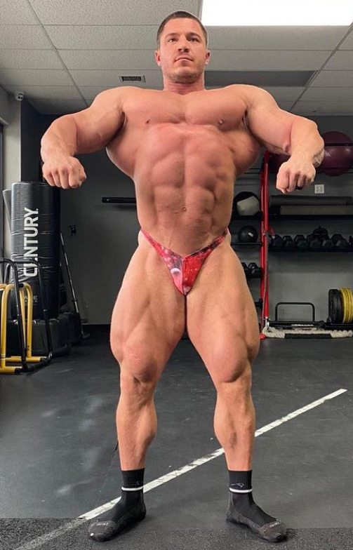 Brett Wilkin