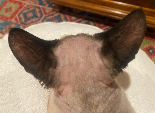 To All The Haters Who Call His Forehead ‘bald’ And ‘moldy’, Ummmm…..look At The Follicles?!