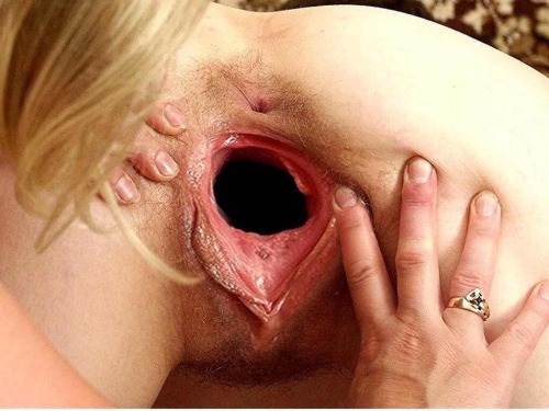 HOLE GAZER