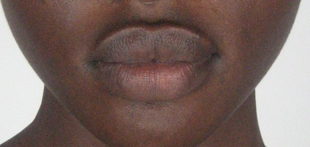 XXX  model lips   2nd to last…damn photo