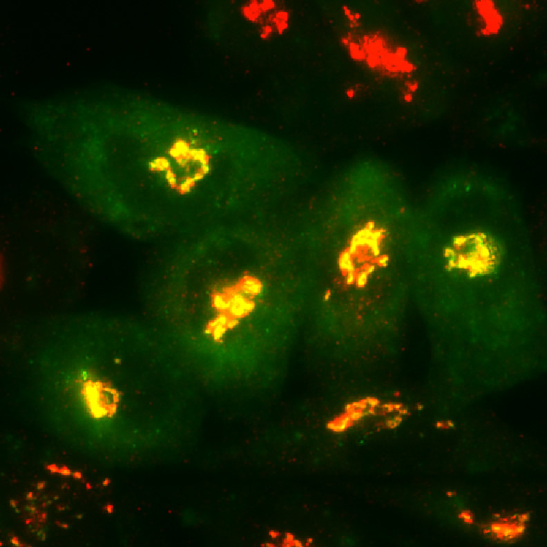 neurosciencestuff:  Scientists slow development of Alzheimer’s trademark cell-killing