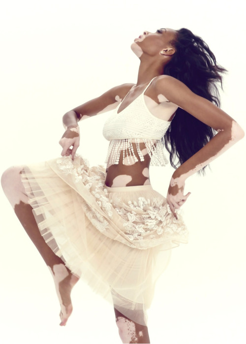 hellyeahchantellewinnie: Chantelle Winnie for Observer Magazine(x)